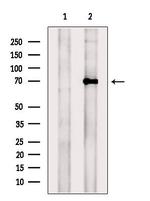 TRPV6 Polyclonal Antibody