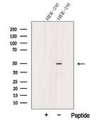 TSP50 Polyclonal Antibody