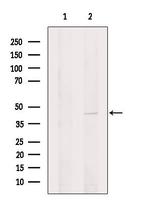 UCK2 Polyclonal Antibody