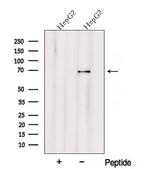 VPS33A Polyclonal Antibody