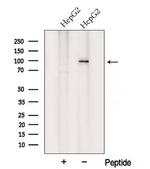 VPS35 Polyclonal Antibody