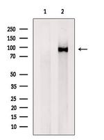 VPS35 Antibody in Western Blot (WB)