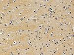 XPO6 Polyclonal Antibody