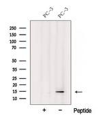 YPEL3 Polyclonal Antibody