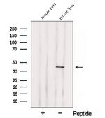 SOAT2 Antibody in Western Blot (WB)