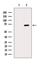 ACSM3 Polyclonal Antibody