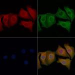 Alcohol Dehydrogenase 1B Polyclonal Antibody