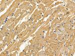 Alcohol Dehydrogenase 1B Antibody in Immunohistochemistry (Paraffin) (IHC (P))