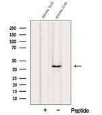 Alcohol Dehydrogenase 1B Antibody in Western Blot (WB)