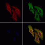 AFAP1L2 Polyclonal Antibody