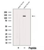 AFAP1L2 Antibody in Western Blot (WB)