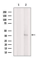 AIPL1 Polyclonal Antibody