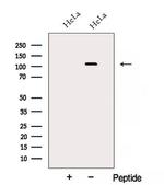 AP3D1 Antibody in Western Blot (WB)