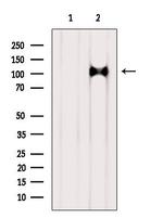AP3D1 Polyclonal Antibody