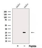 ARD1A Antibody in Western Blot (WB)