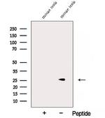 NAA11 Polyclonal Antibody