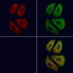 ARHGAP15 Polyclonal Antibody