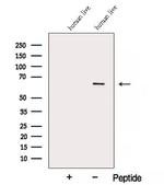 ARHGAP15 Antibody in Western Blot (WB)