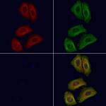 ARL7 Polyclonal Antibody