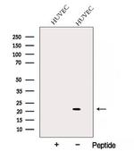 ARL7 Antibody in Western Blot (WB)