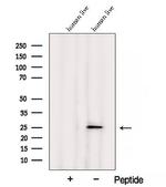 ARL5B Antibody in Western Blot (WB)
