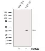 ARMC10 Antibody in Western Blot (WB)