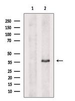 ARMC10 Antibody in Western Blot (WB)