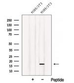 ATP5D Polyclonal Antibody