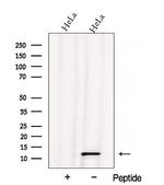ATPIF1 Polyclonal Antibody