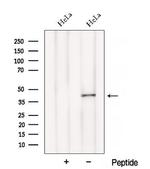BCAT1 Polyclonal Antibody