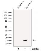 BEX1/BEX2 Polyclonal Antibody