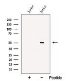 BTN3A1 Polyclonal Antibody
