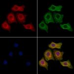 CaBP8 Polyclonal Antibody