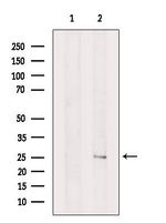 CaBP8 Antibody in Western Blot (WB)