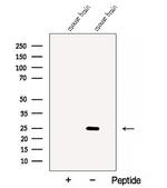 CaBP8 Antibody in Western Blot (WB)