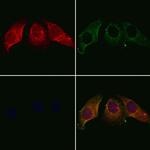 Calumenin Polyclonal Antibody