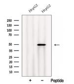 Calumenin Antibody in Western Blot (WB)