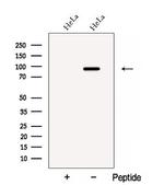 ATPGD1 Polyclonal Antibody