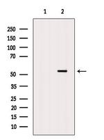 Cathepsin F Antibody in Western Blot (WB)