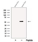 Cathepsin F Polyclonal Antibody