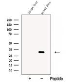 CBY1 Antibody in Western Blot (WB)