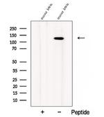 CC2D1B Polyclonal Antibody