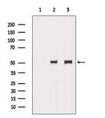 TCP-1 delta Polyclonal Antibody