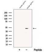 CD84 Polyclonal Antibody