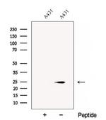 CHMP1A Antibody in Western Blot (WB)