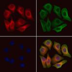 CHMP1B Polyclonal Antibody