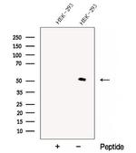 CHMP7 Polyclonal Antibody