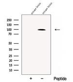 Chromogranin B Polyclonal Antibody