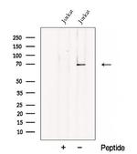 CHST15 Polyclonal Antibody