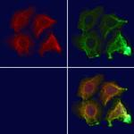 CNKSR3 Polyclonal Antibody
